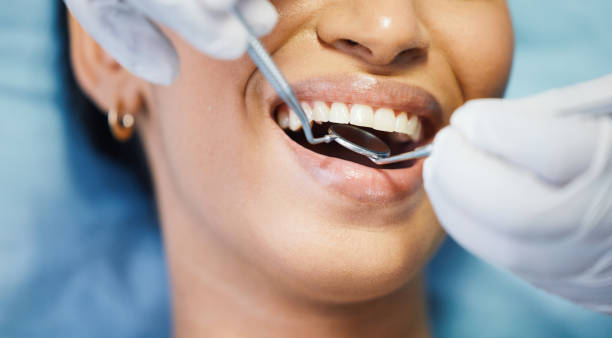 Best Emergency Tooth Extraction in Ben Lomond, CA
