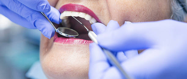 Best Emergency Dental Surgery in Ben Lomond, CA